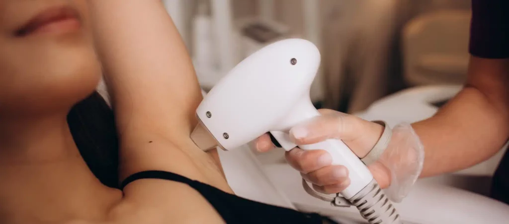 épilation laser Colmar